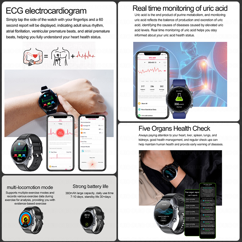 Jam Tangan Pintar Pemeriksa Ke - Smartwatch Watches For Women Brands ulasan dan harga
